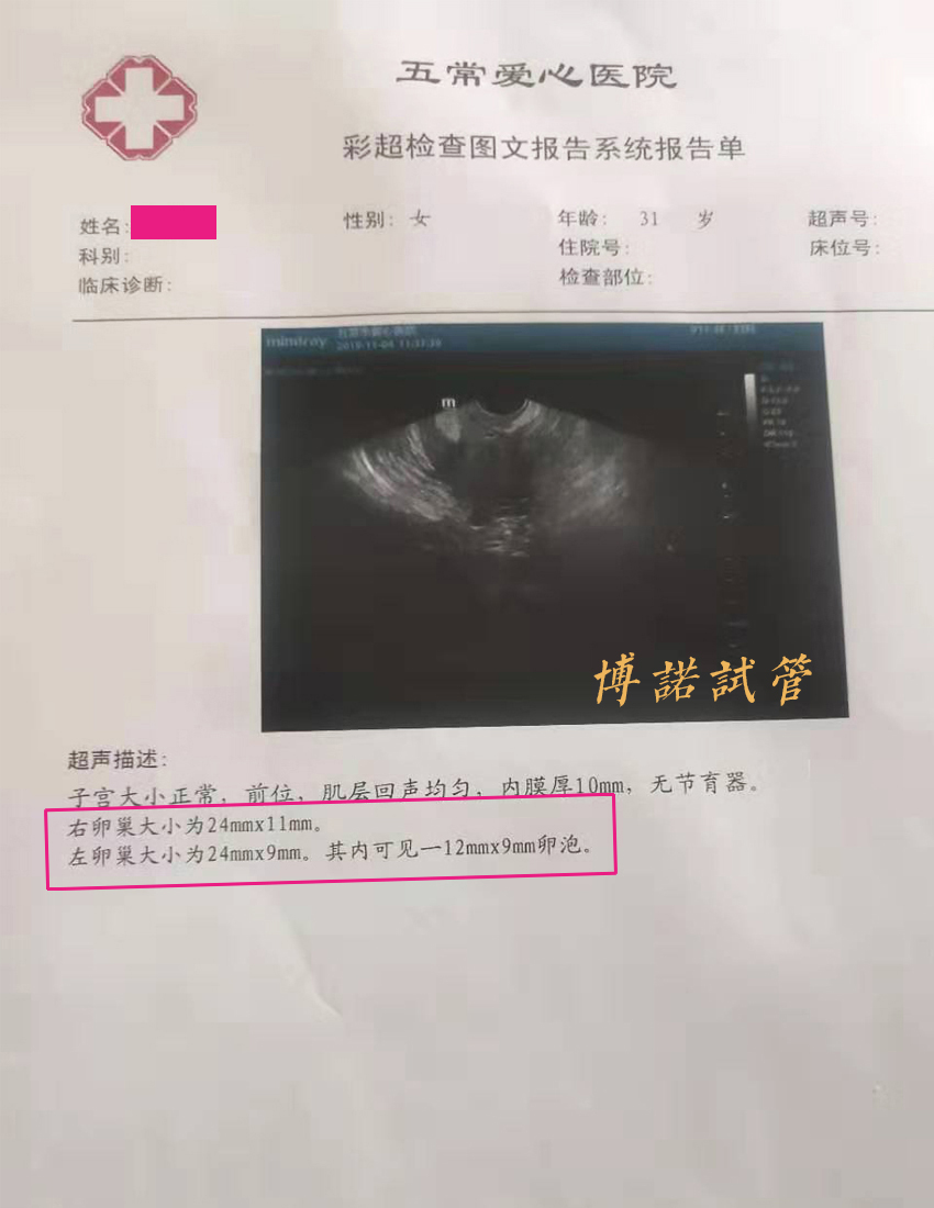 深圳借卵费用.jpg