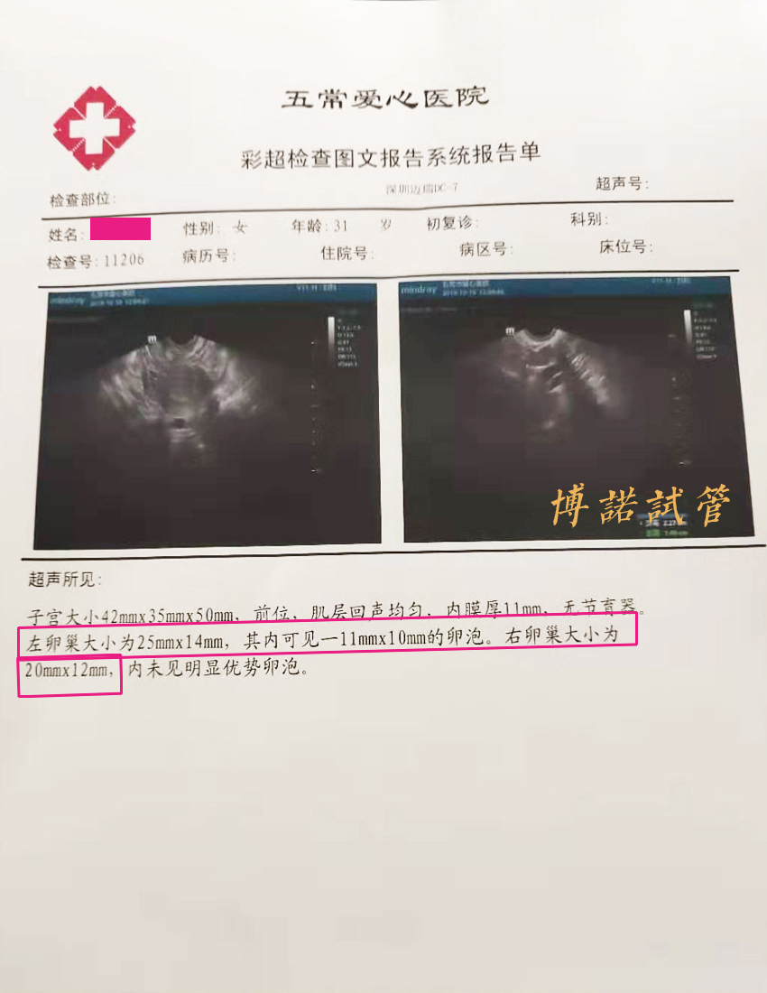 深圳借卵生子.jpg