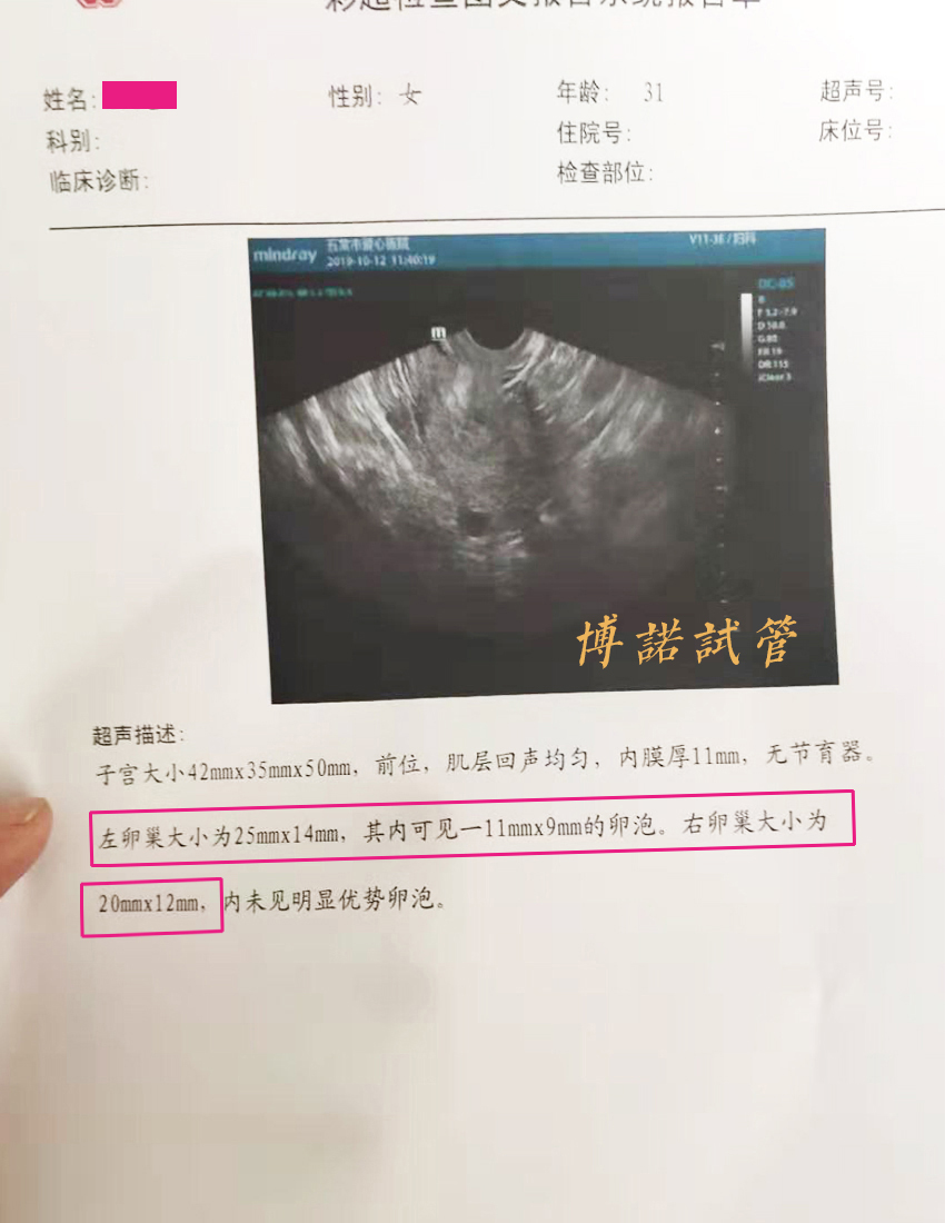 深圳借卵试管医院.jpg