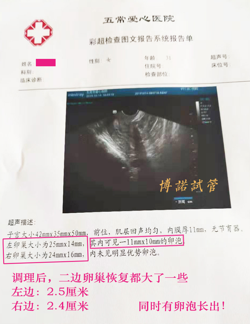 深圳借卵怀孕经历.jpg