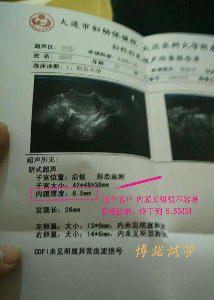 深圳借卵试管婴儿.jpg