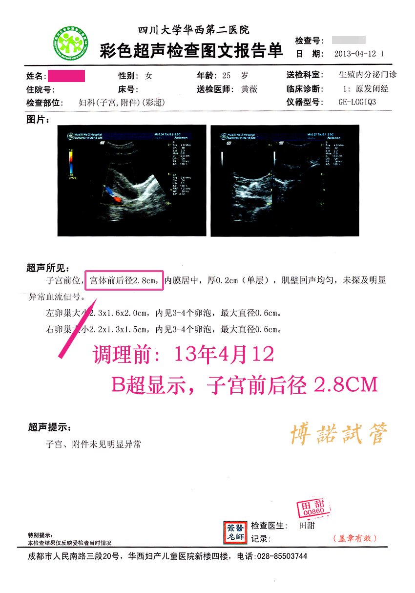 深圳借卵试管.jpg